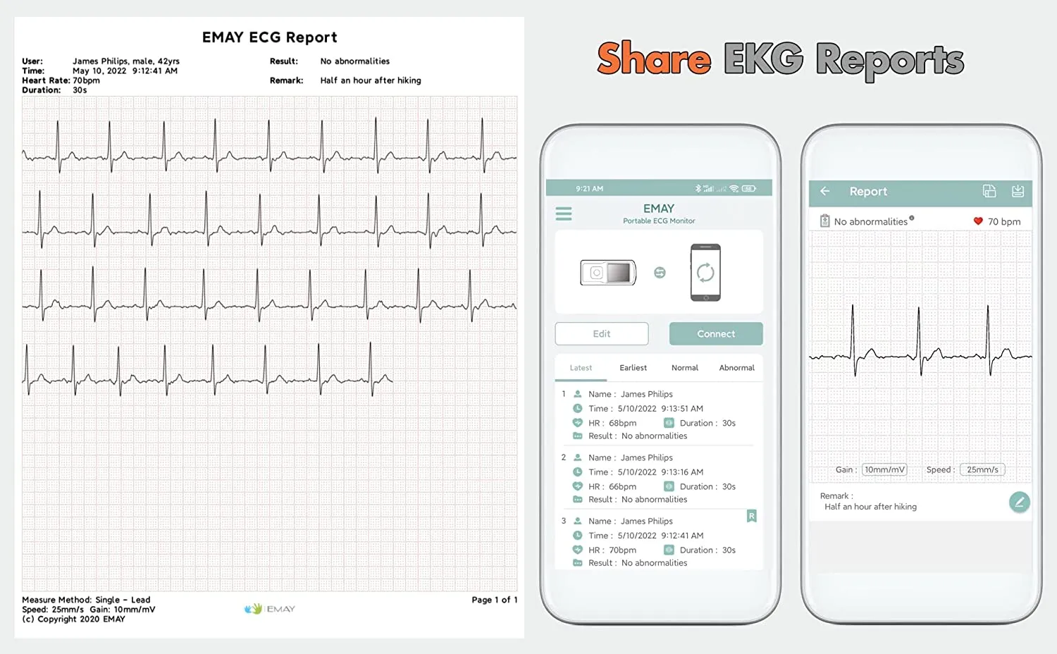 Portable ECG Monitor (for iPhone & Android, Mac & Windows) | Wireless EKG Monitoring Devices with Heart Rate & Rhythm Tracking