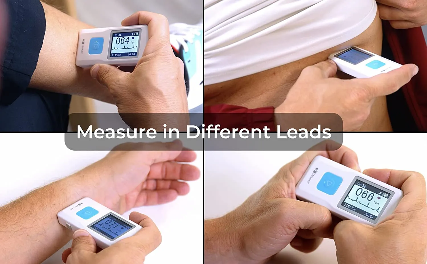 Portable ECG Monitor (for iPhone & Android, Mac & Windows) | Wireless EKG Monitoring Devices with Heart Rate & Rhythm Tracking